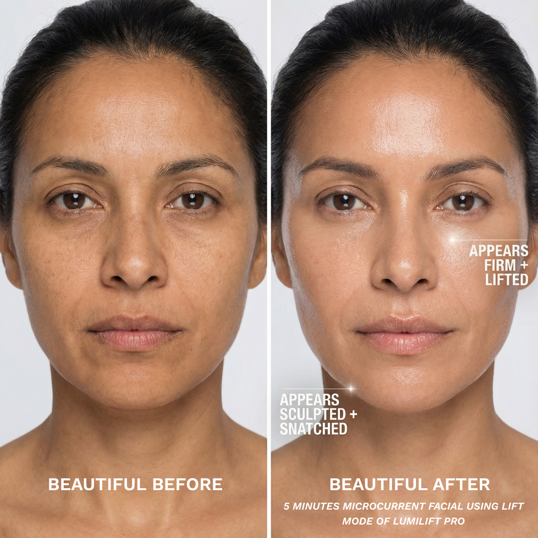 After 5 minutes of Lift Mode