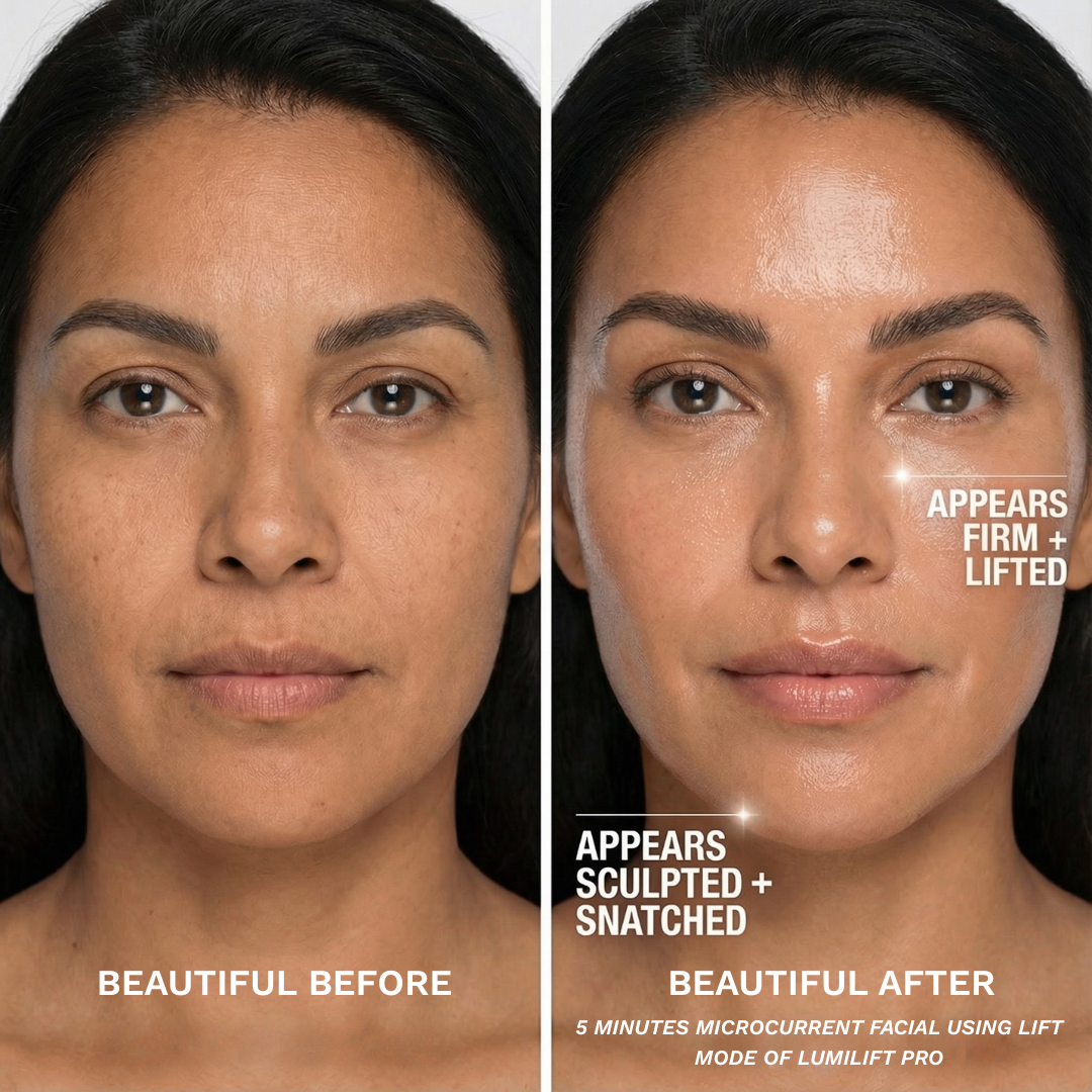 After 5 minutes of Lift Mode