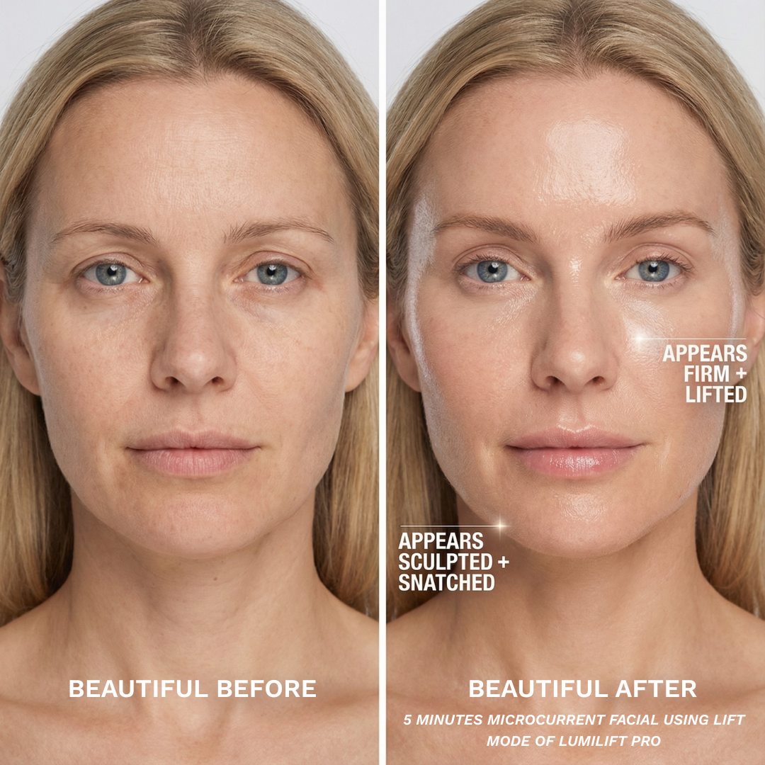 After 5 minutes of Lift Mode