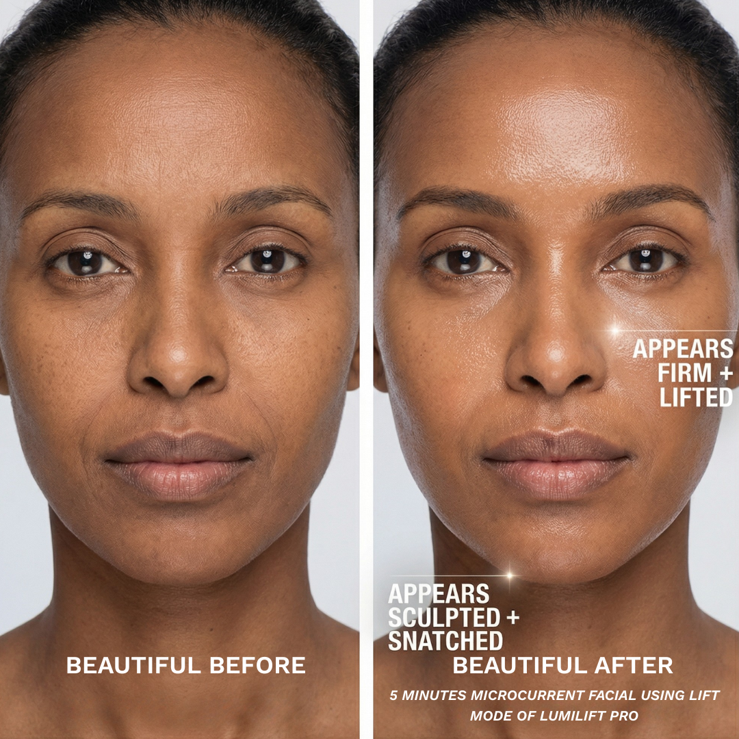 After 5 minutes of Lift Mode