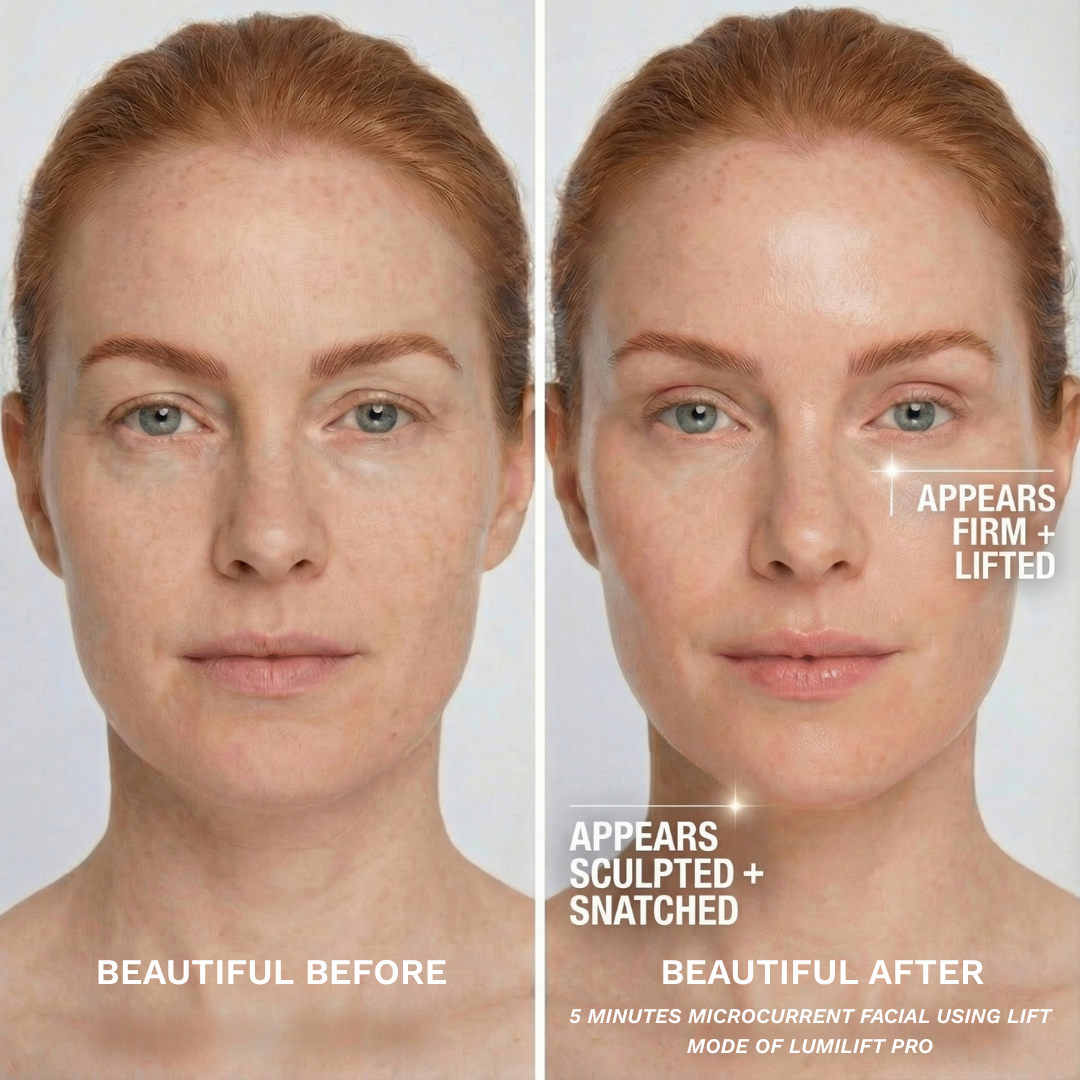 After 5 minutes of Lift Mode