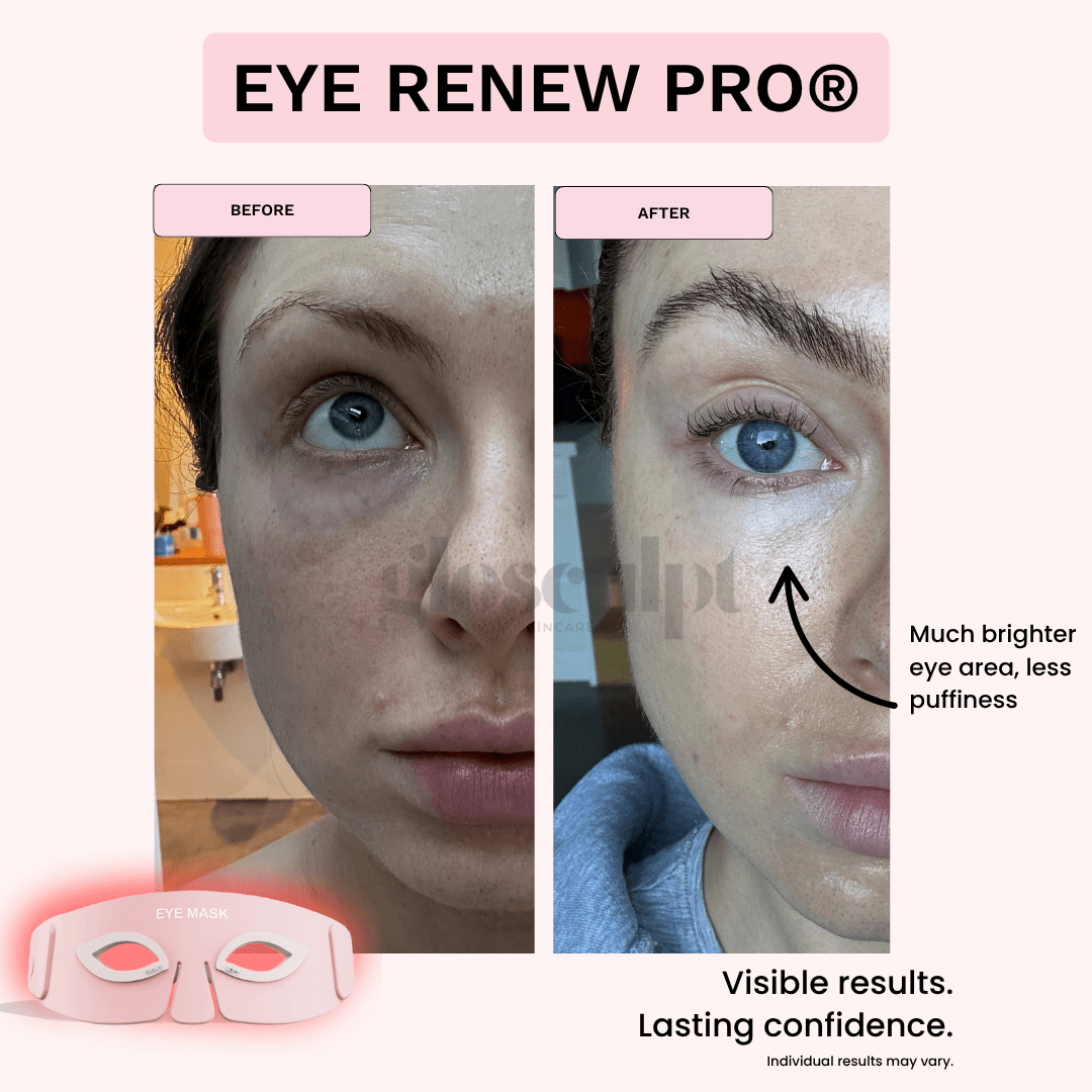 Eye Renew Pro®: 4 - in - 1 Bright Eyes Red Light Mask - GloSculpt Skin