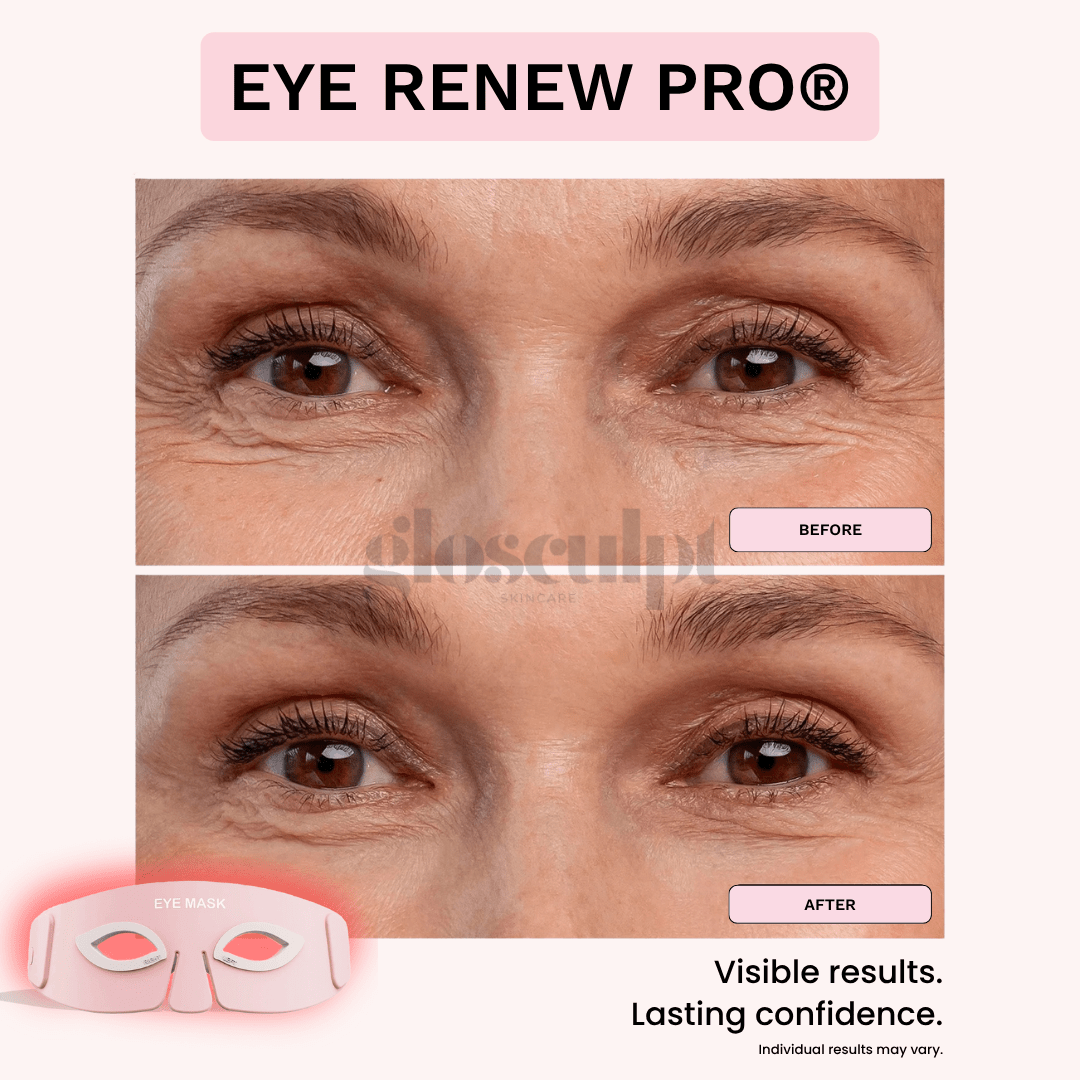 Eye Renew Pro®: 4 - in - 1 Bright Eyes Red Light Mask - GloSculpt Skin