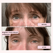 Eye Renew Pro - Bright Eyes Red Light Mask - GloSculpt Skin