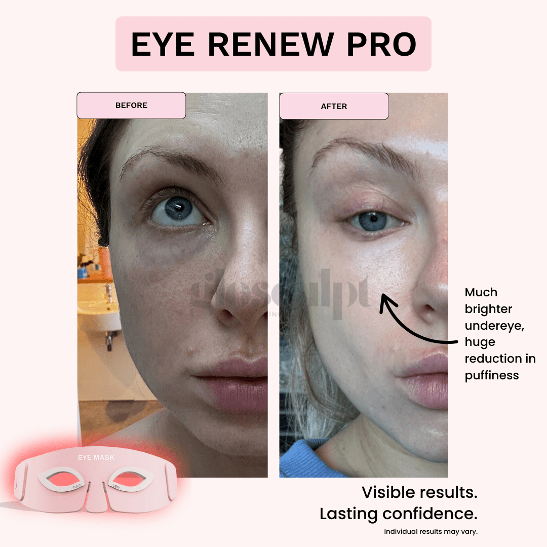 Eye Renew Pro - Wrinkle Eraser Mask - GloSculpt Skin