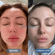 Glo 4 - in - 1 Pro LED Light Therapy Mask - GloSculpt Skin