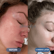 Glo 4 - in - 1 Pro LED Light Therapy Mask - GloSculpt Skin