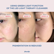 Glo Cleansing Brush With LED Light Therapy - GloSculpt Skin