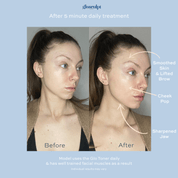 Glo Toner Device with LED Light Therapy - GloSculpt Skin
