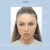 Glo Toner Device with LED Light Therapy - GloSculpt Skin