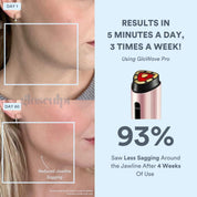 GloWave Pro Wand - GloSculpt Skin