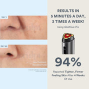 GloWave Pro Wand - GloSculpt Skin
