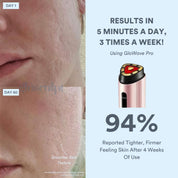 GloWave Pro Wand - GloSculpt Skin