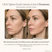 LumiLift Pro Wand - GloSculpt Skin