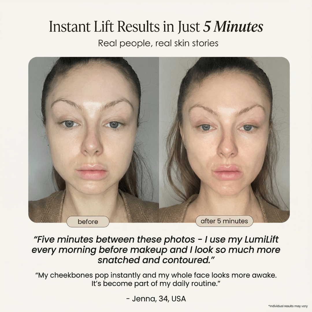 LumiLift Pro Wand - GloSculpt Skin