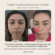 LumiLift Pro Wand - GloSculpt Skin